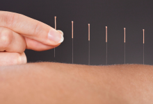 Tüp Bebek Tedavisinde Akupunktur Uygulaması