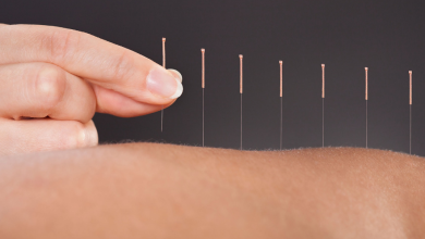 Tüp Bebek Tedavisinde Akupunktur Uygulaması
